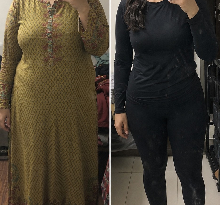 Ninety-day before and after