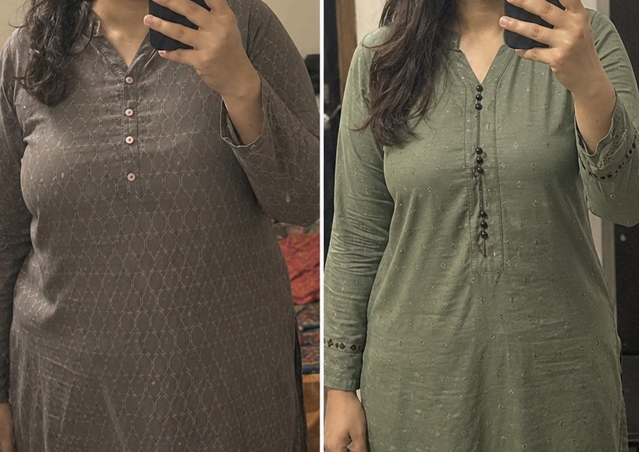 Ninety-day before and after