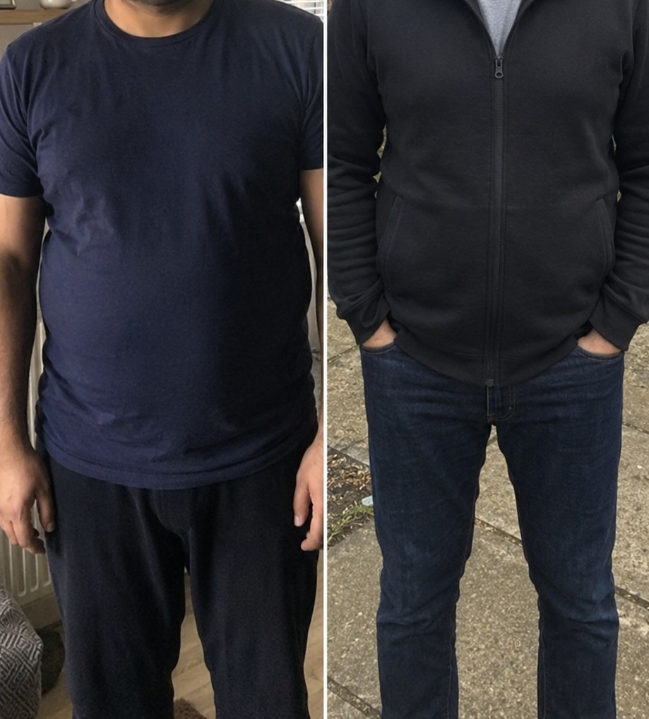 Ninety-day before and after